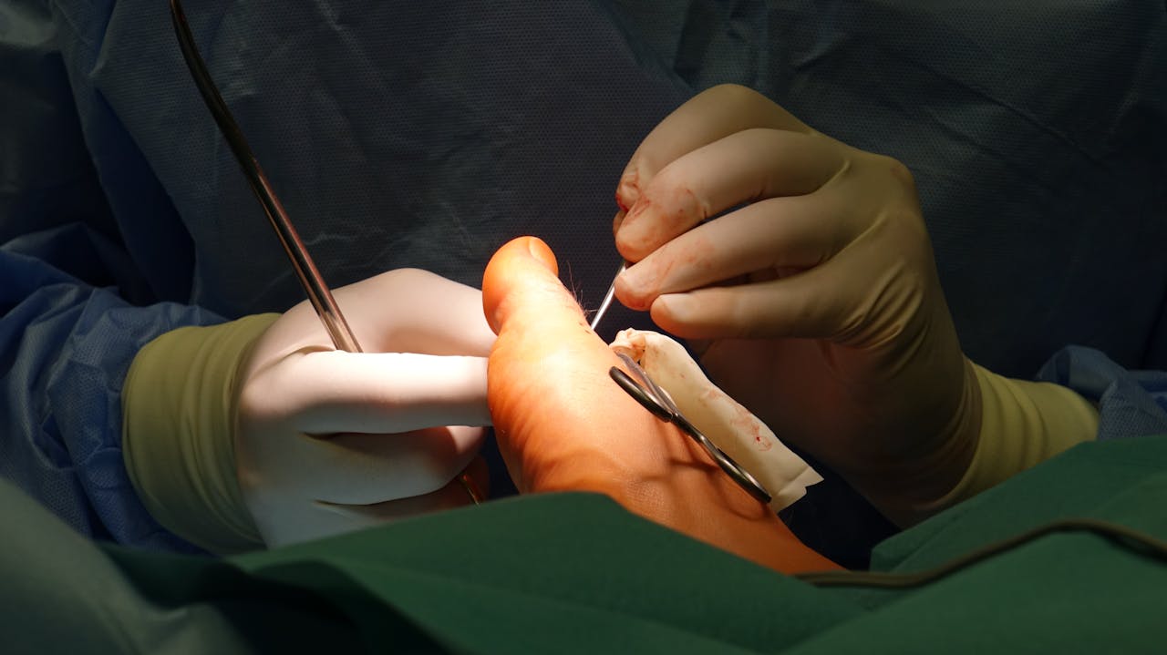 Surgeons perform intricate foot surgery procedure with precision in a sterile operating room.